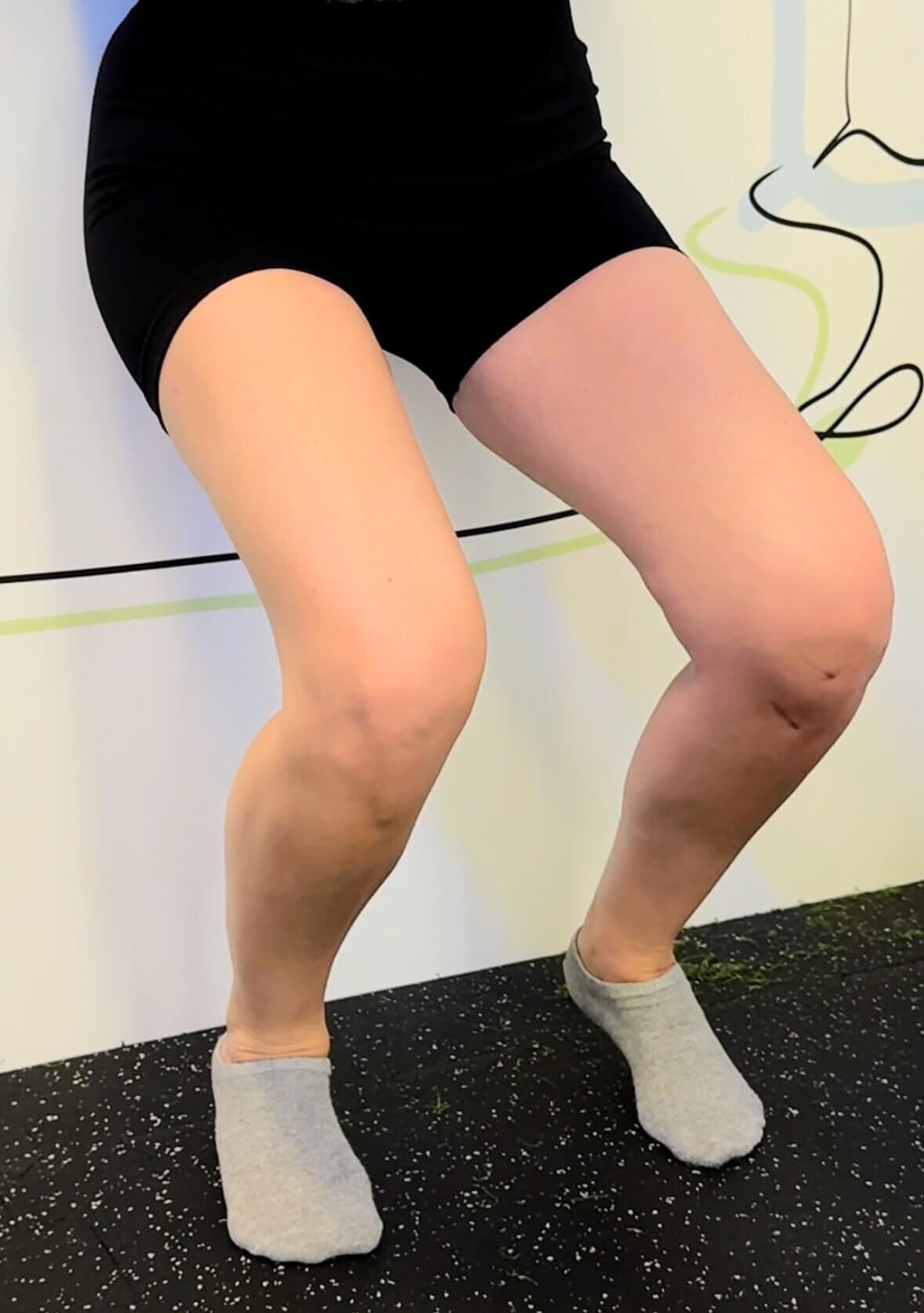 Fizjoterapia kolana pacjenta w Warszawie